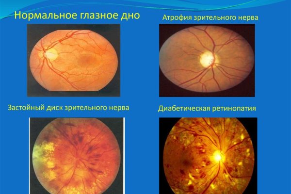 Официальный сайт кракен тор